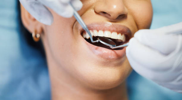 Best Emergency Root Canal Treatment in Lochbuie, CO